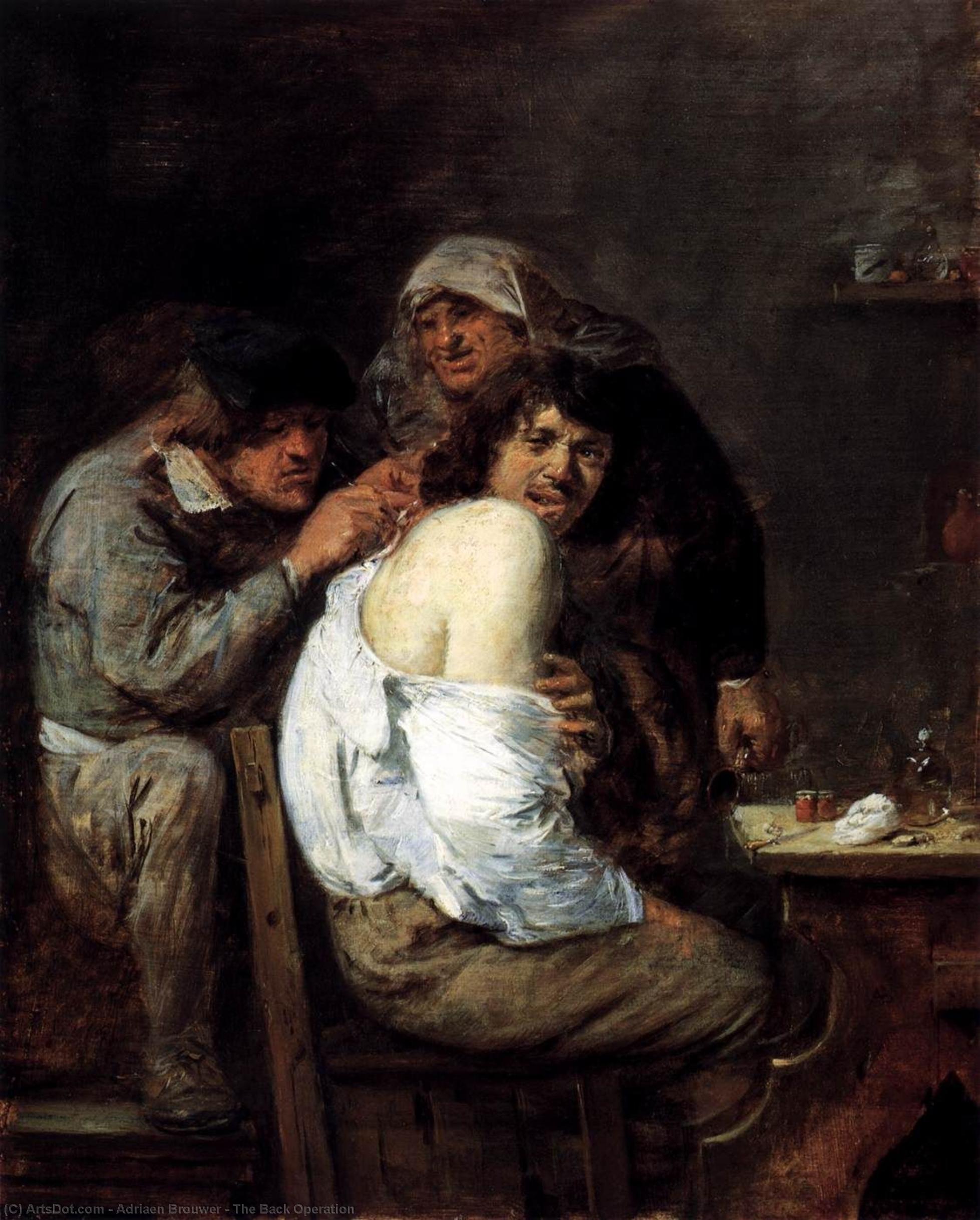Wikioo.org - The Encyclopedia of Fine Arts - Painting, Artwork by Adriaen Brouwer - The Back Operation