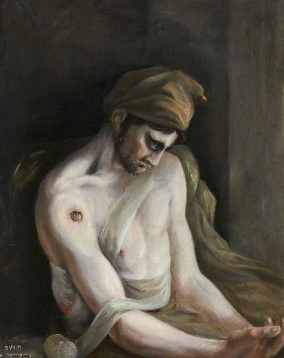 Wikioo.org - The Encyclopedia of Fine Arts - Painting, Artwork by Charles Bell - The Wounded following the Battle of Corunna Gunshot Wound of Humerus