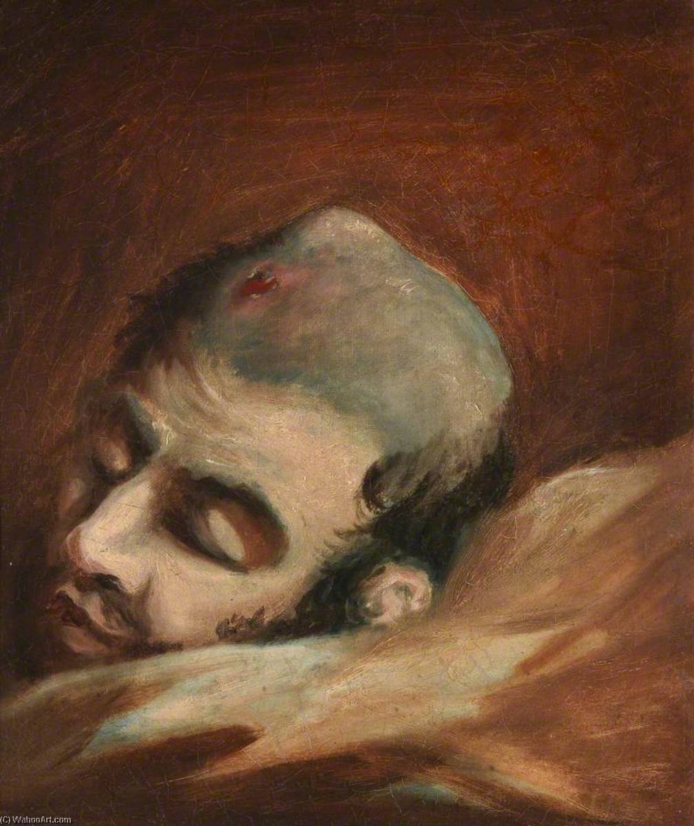 Wikioo.org - The Encyclopedia of Fine Arts - Painting, Artwork by Charles Bell - The Wounded following the Battle of Corunna Bullet Wound of Skull