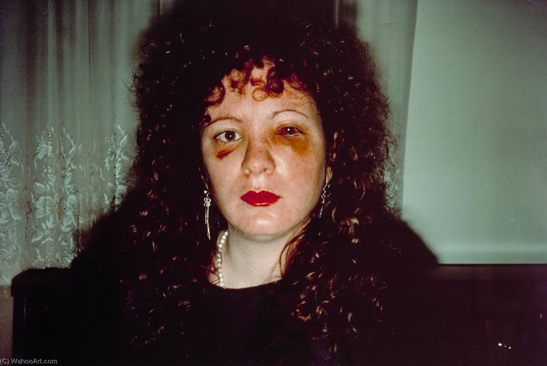 Wikioo.org - The Encyclopedia of Fine Arts - Painting, Artwork by Nan Goldin - Nan one month after being battered
