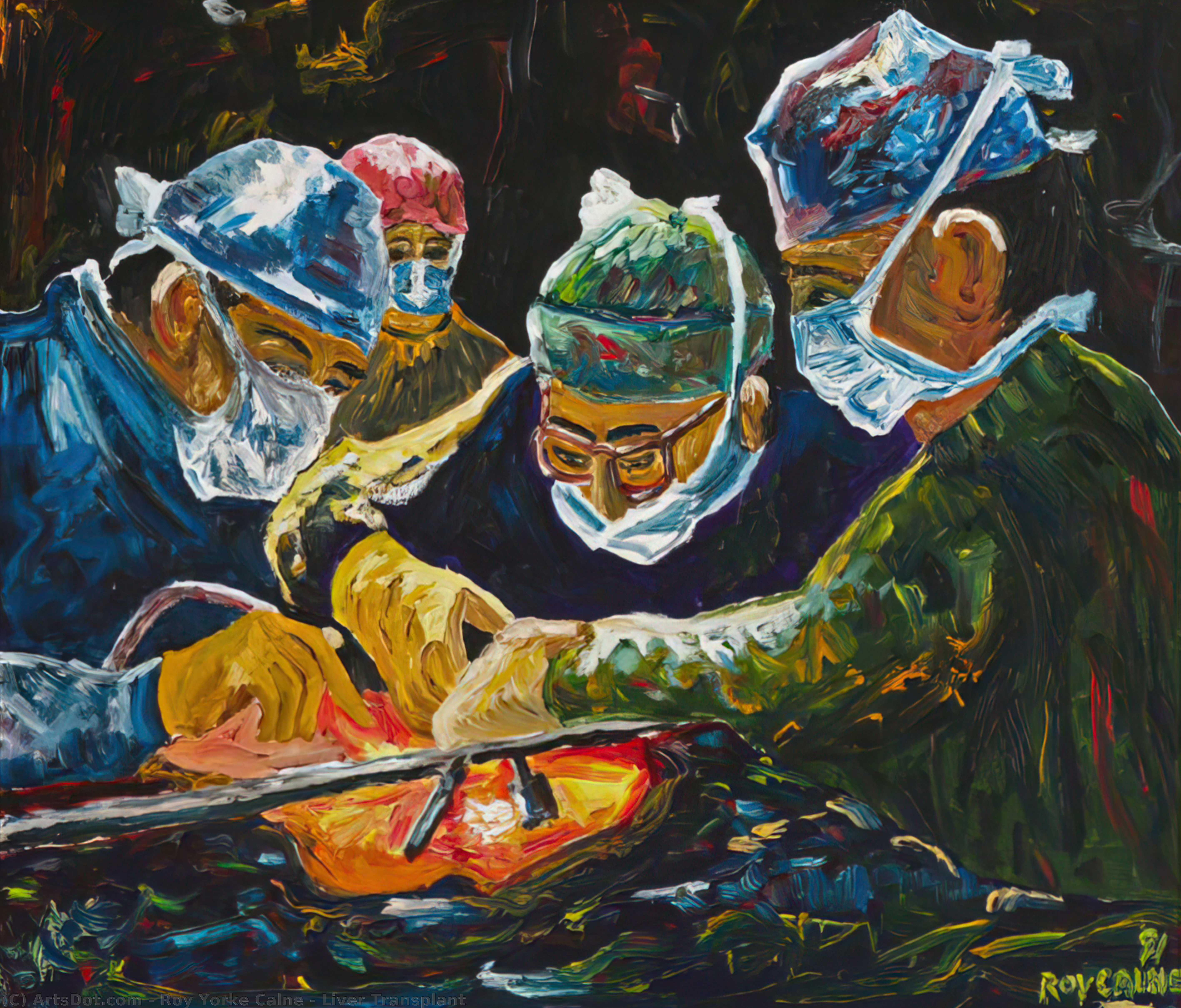 Wikioo.org - The Encyclopedia of Fine Arts - Painting, Artwork by Roy Yorke Calne - Liver Transplant
